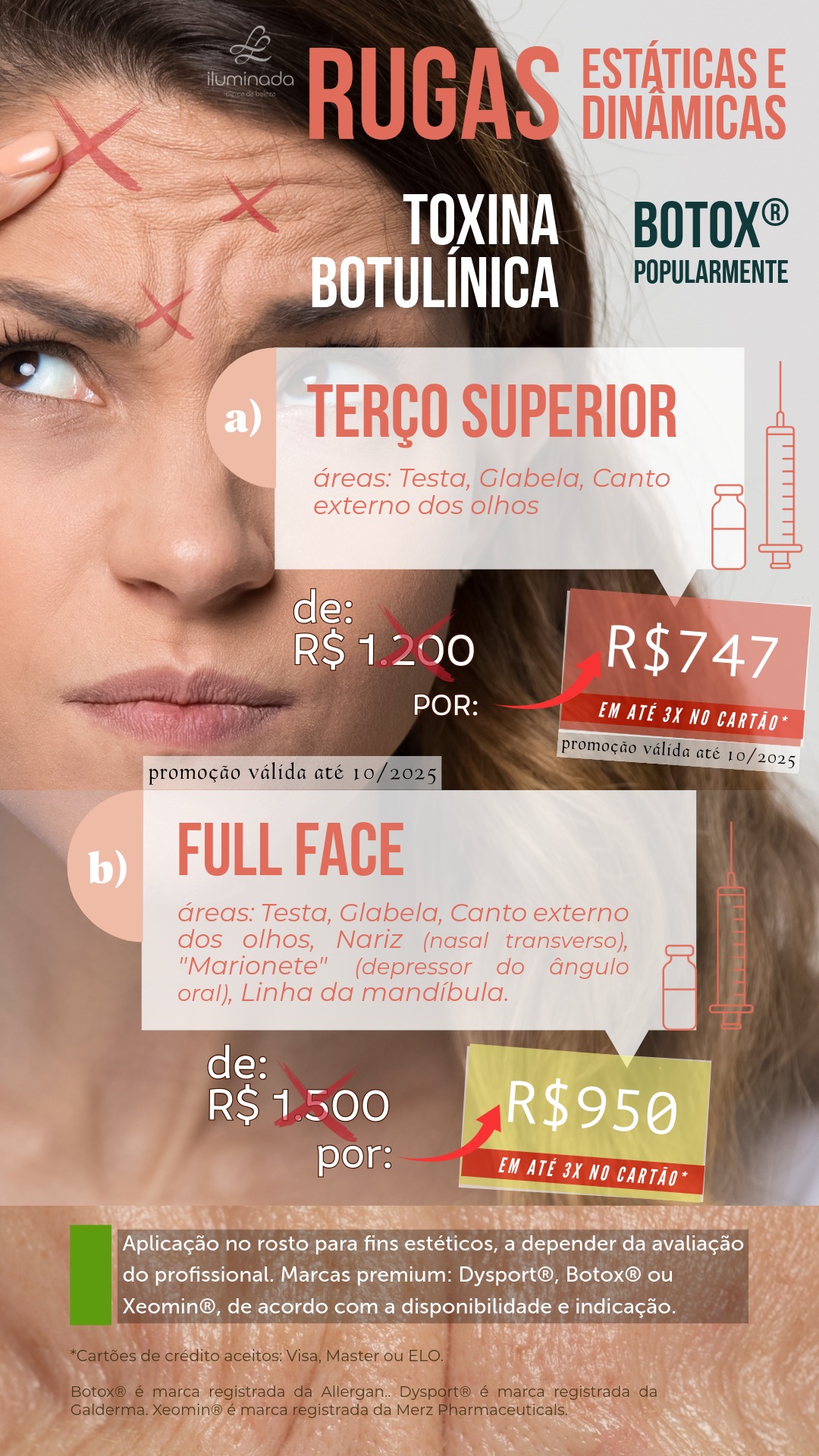 BOTOX Popularmente