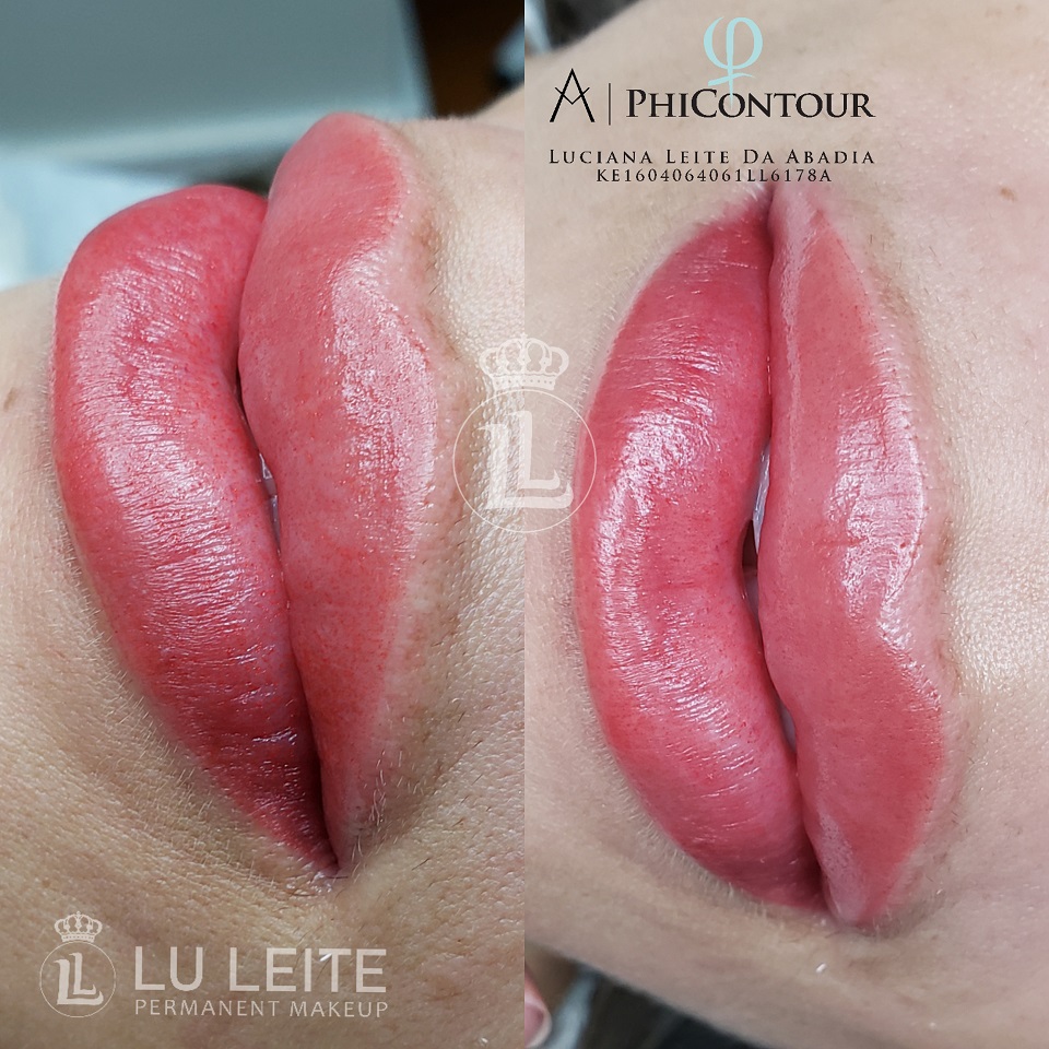 Antes e depois